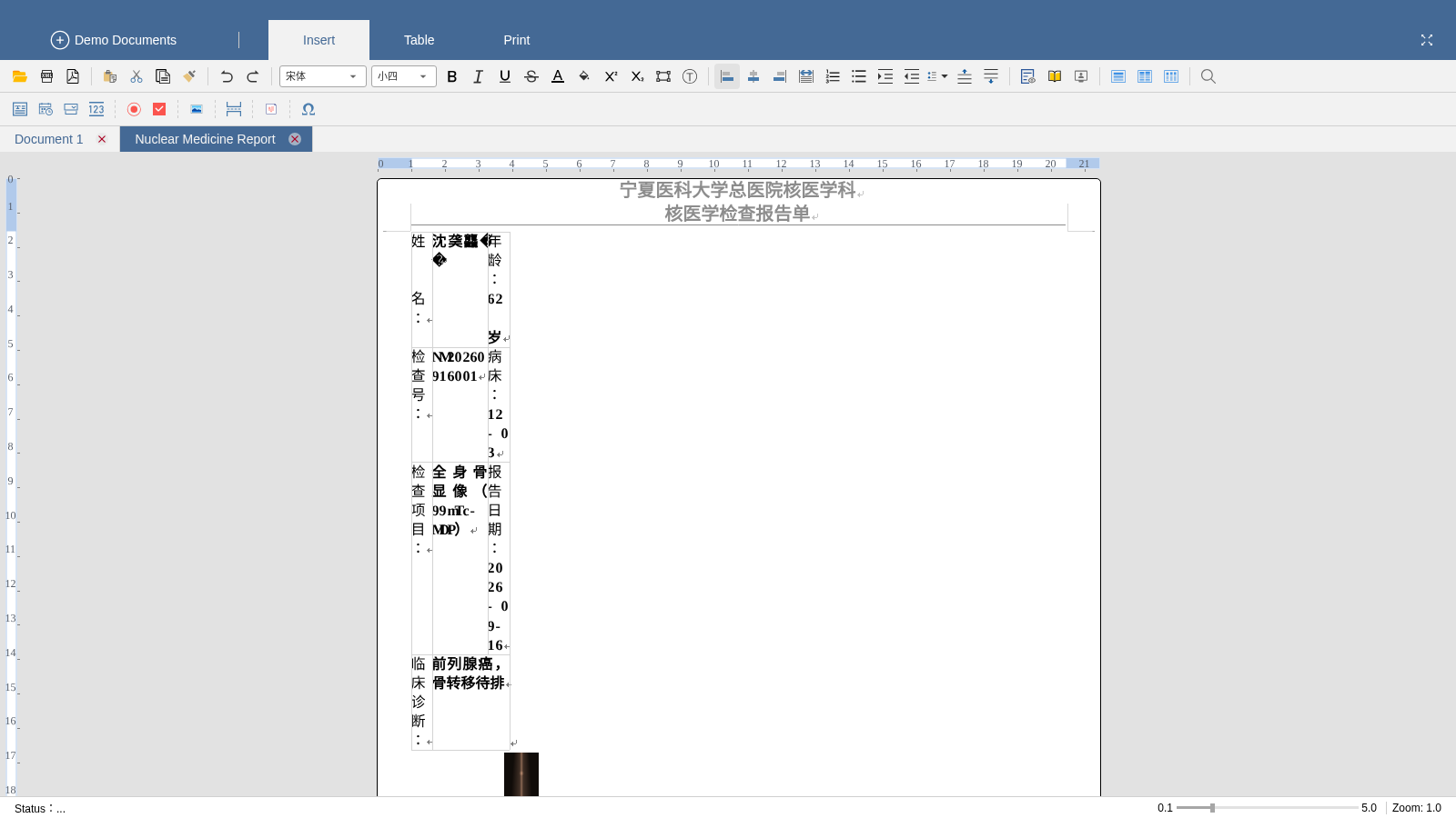 DCWriterLite Demo 封面